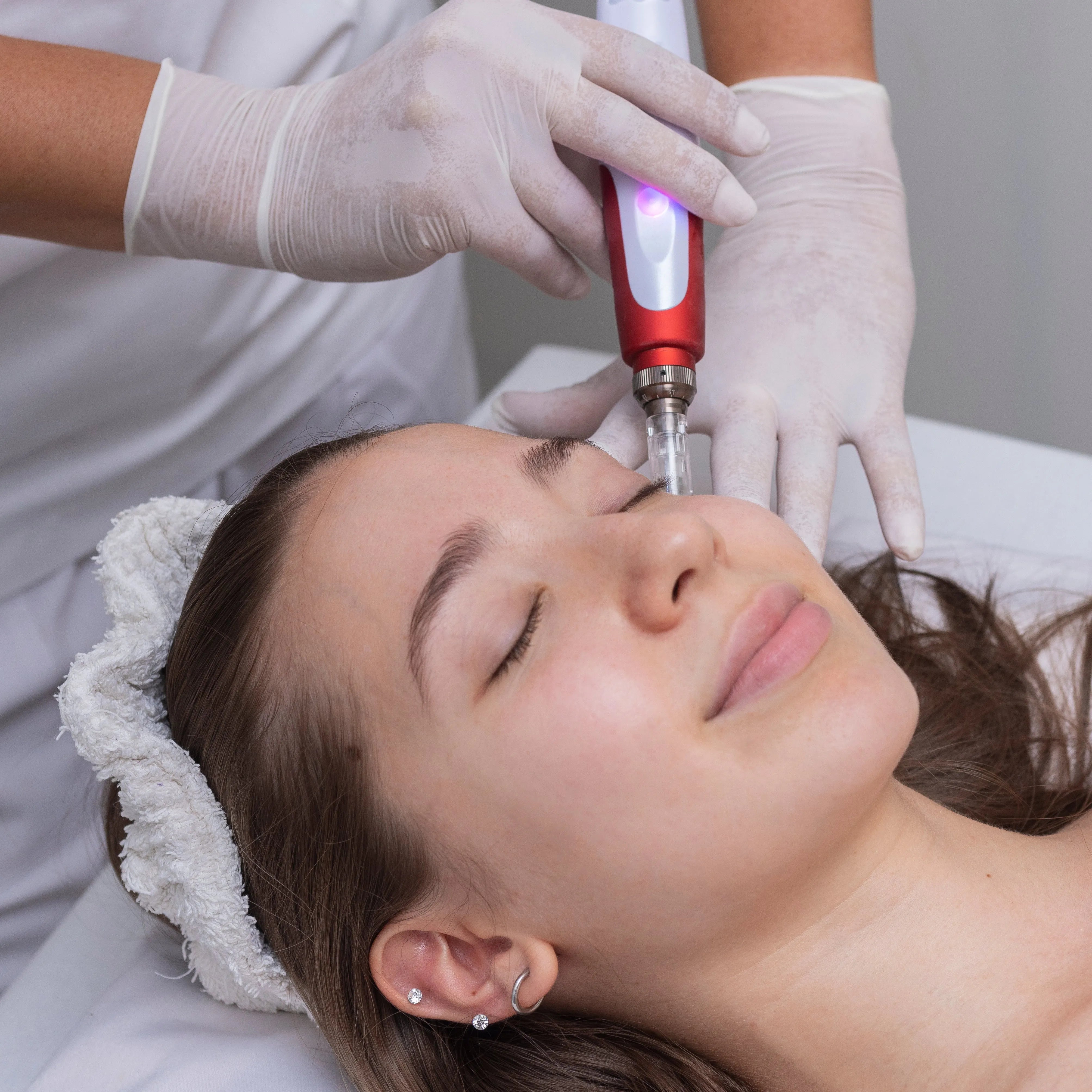 Jalupro Glow Peel  + Mikronakłuwanie na twarz, szyję i dekolt